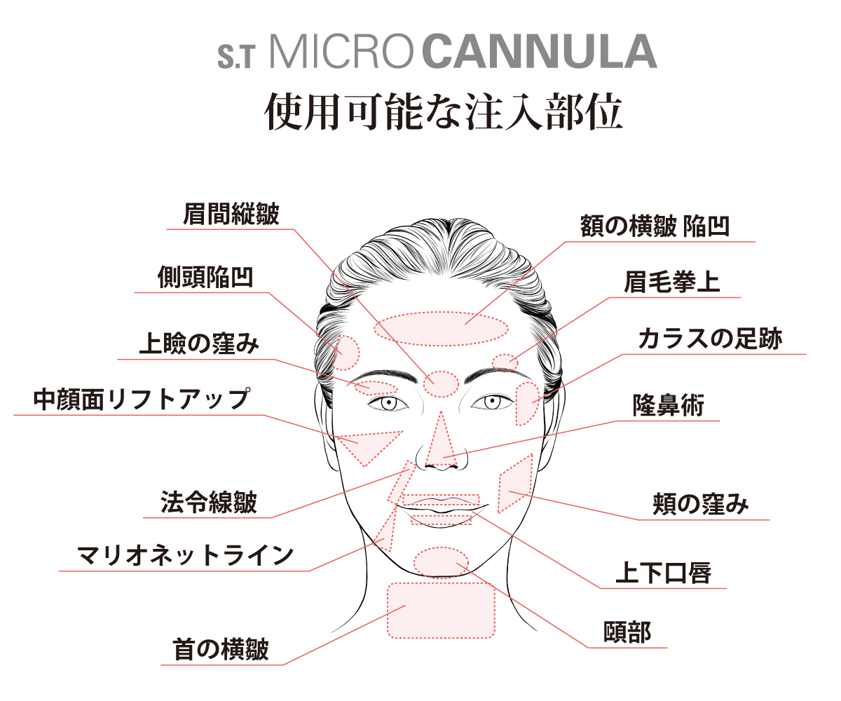 使用可能な注入部位